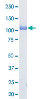 Loading 1 &mu;g protein in SDS-PAGE